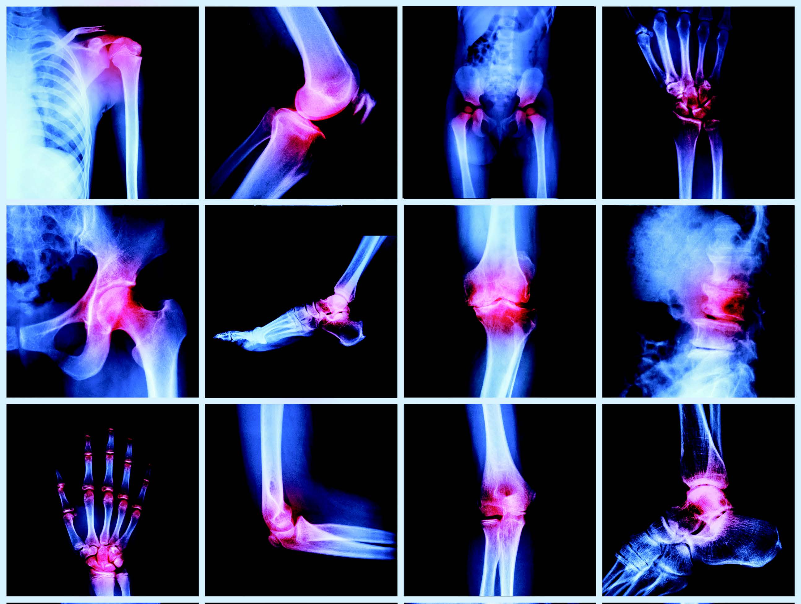 orthopedic doctor in patna, best orthopedic doctor in patna, top orthopedic doctor in patna, top ten orthopedic doctor in patna, bone doctor in patna, bone specialist in patna, best bone doctor in patna.