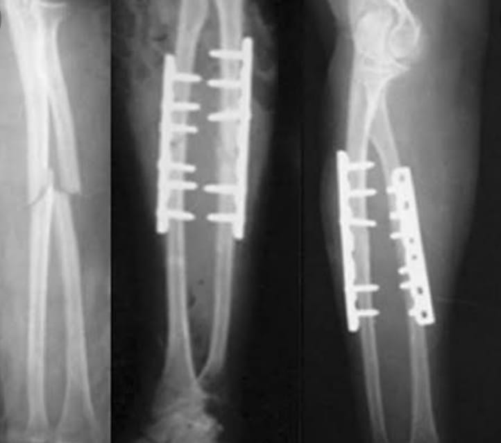 orthopedic doctor in patna, best orthopedic doctor in patna, top orthopedic doctor in patna, top ten orthopedic doctor in patna, bone doctor in patna, bone specialist in patna, best bone doctor in patna.