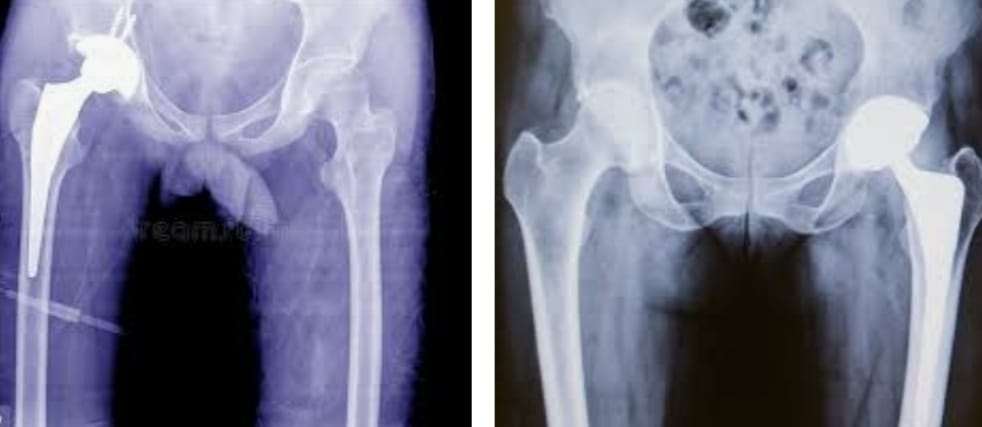 orthopedic doctor in patna, best orthopedic doctor in patna, top orthopedic doctor in patna, top ten orthopedic doctor in patna, bone doctor in patna, bone specialist in patna, best bone doctor in patna.