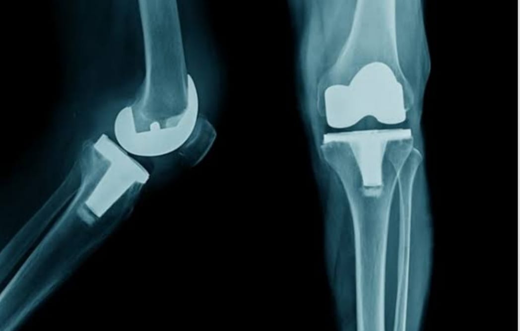 orthopedic doctor in patna, best orthopedic doctor in patna, top orthopedic doctor in patna, top ten orthopedic doctor in patna, bone doctor in patna, bone specialist in patna, best bone doctor in patna.